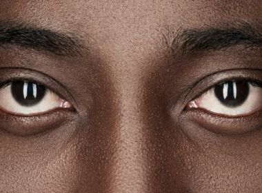 Somente 67 municípios brasileiros aderiram a sistema contra desigualdade racial do governo