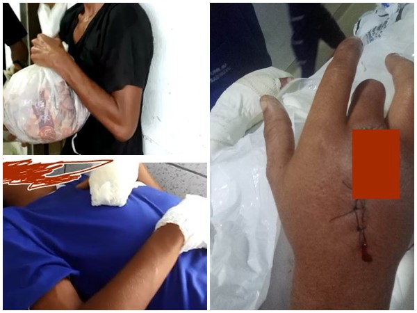 Itororó: Polícia investiga caso de adolescente de 16 anos que levou um tiro nas mãos após roubar carne