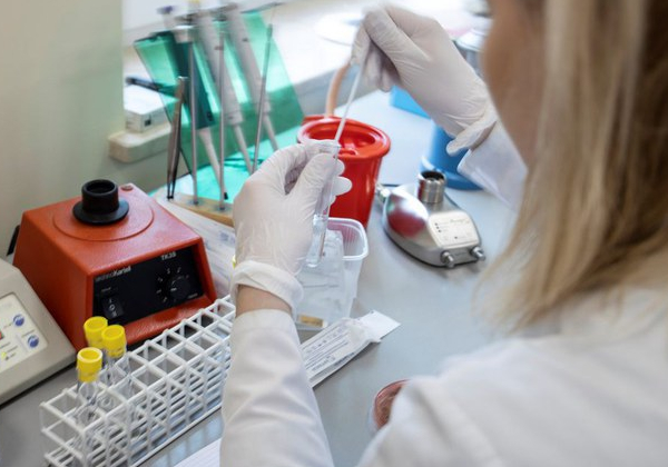 Para evitar falta de testes, laboratórios são orientados a reservá-los a casos graves
