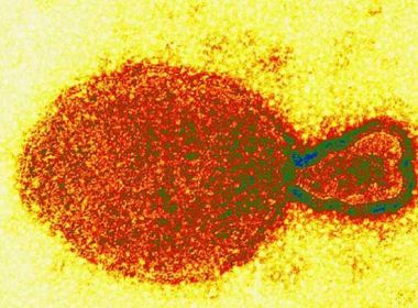 Cientistas chineses identificam novo vírus em humanos: ‘Langya henipavirus’