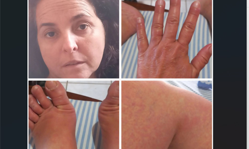 Repórter da Rede Bahia enfrenta séria doença e é afastada, temporariamente, da TV