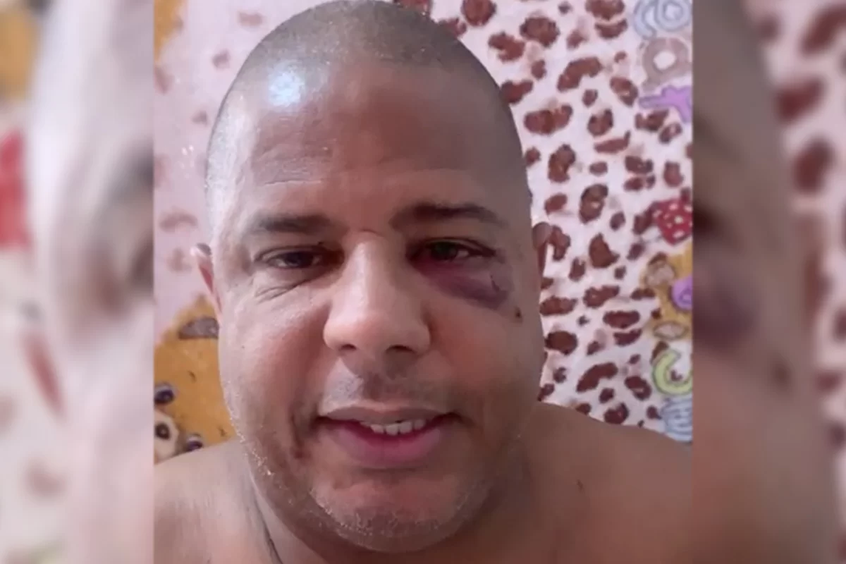 Com sinais de agressão, Marcelinho Carioca grava vídeo sobre sequestro