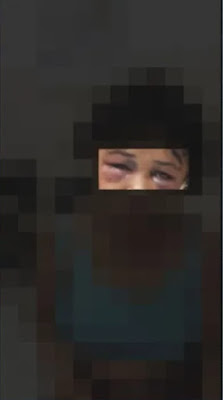 Mulher agredida e queimada com maçarico na BA sofria agressões frequentes do companheiro, relata família