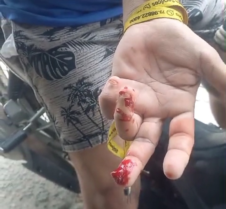 Vídeo de Homem Supostamente Atacado por Piranhas em Rio de Itapetinga Viraliza nas Redes Sociais