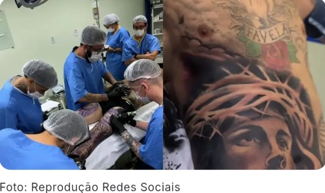Conselho Federal de Medicina publica resolução que proíbe aplicar anestesia para fazer tatuagem