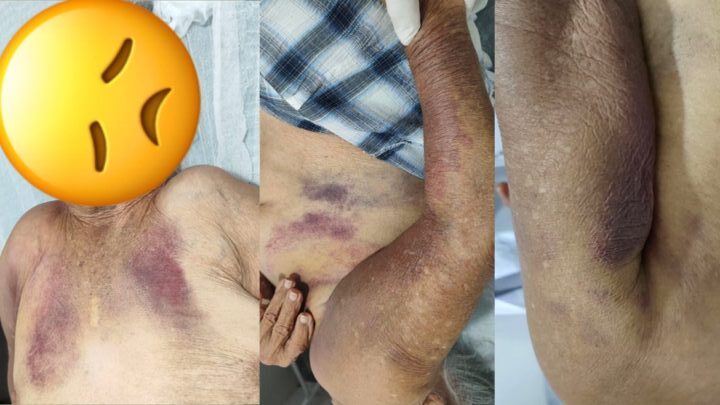 Suspeita de maus-tratos a idosa mobiliza autoridades em Firmino Alves